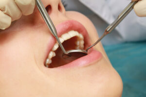 Dental checkup - Mississauga Dentist - Bristol Dental
