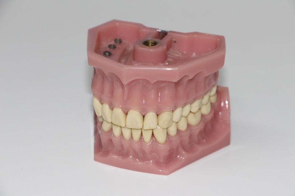 Model teeth - Mississauga Dentist - Bristol Dental