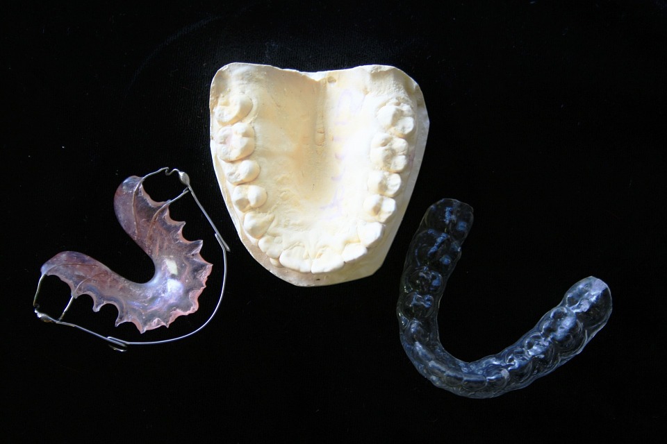 Types of braces - Mississauga Dentist - Bristol Dental