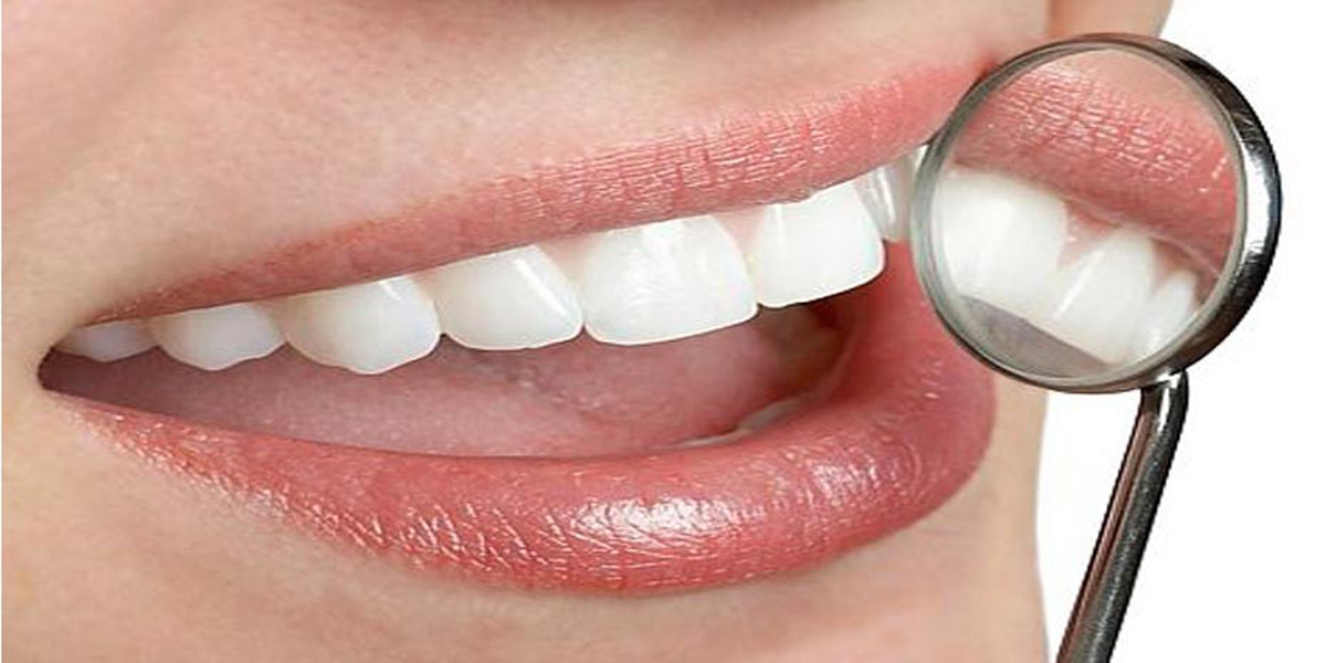 Restore Teeth- Mississauga Dentists - Bristol Dental Care