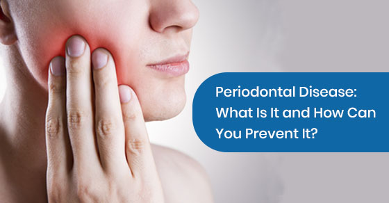 Periodontal Disease: What Is It and How Can You Prevent It?