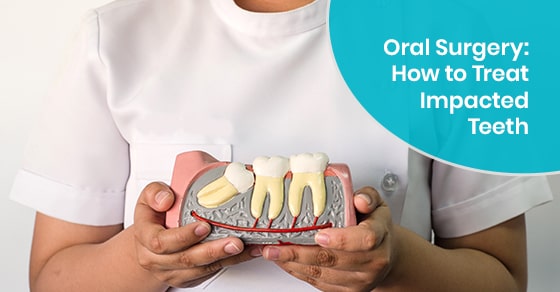Oral surgery to treat impacted teeth
