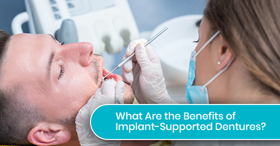 Benefits of Implant-Supported Dentures