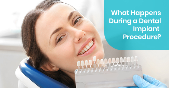 What Happens During a Dental Implant Procedure?