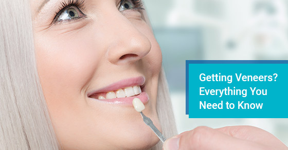 What to know before getting veneers