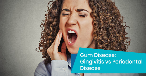 Difference between gingivitis vs periodontal gum disease