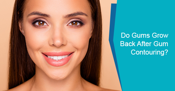 Will gums grow back after gum contouring?