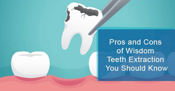 Pros and Cons of Wisdom Teeth Extraction You Should Know
