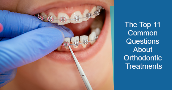 The Top 11 Common Questions About Orthodontic Treatments
