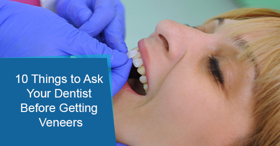A few questions to ask your dentist before getting veneers