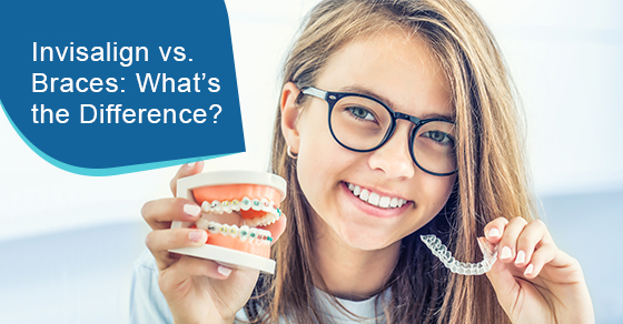 What’s the difference between Invisalign and braces?