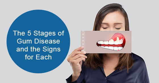Stages of gum disease and the signs for each