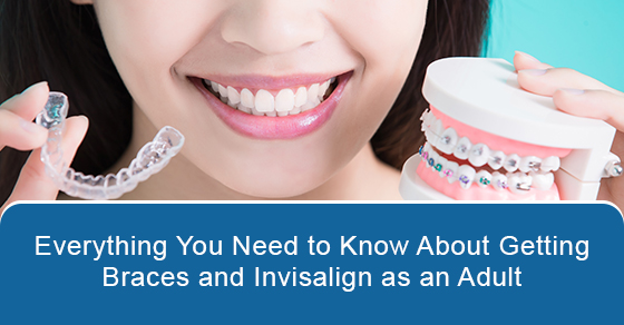 Everything you need to know about getting braces and invisalign as an adult