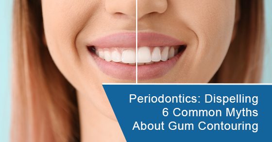 Periodontics: Dispelling 6 common myths about gum contouring