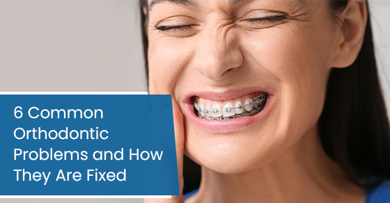 6 common orthodontic problems and how they are fixed
