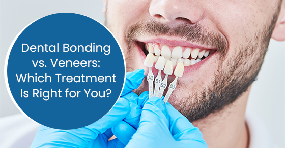 Dental bonding vs. Veneers: Which treatment is right for you?