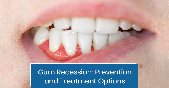 Gum recession: Prevention and treatment options