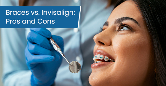 Braces vs. Invisalign: Pros and cons