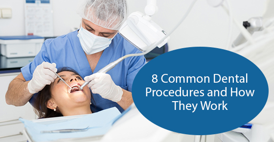 8 common dental procedures and how they work