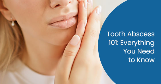 Tooth abscess 101: everything you need to know