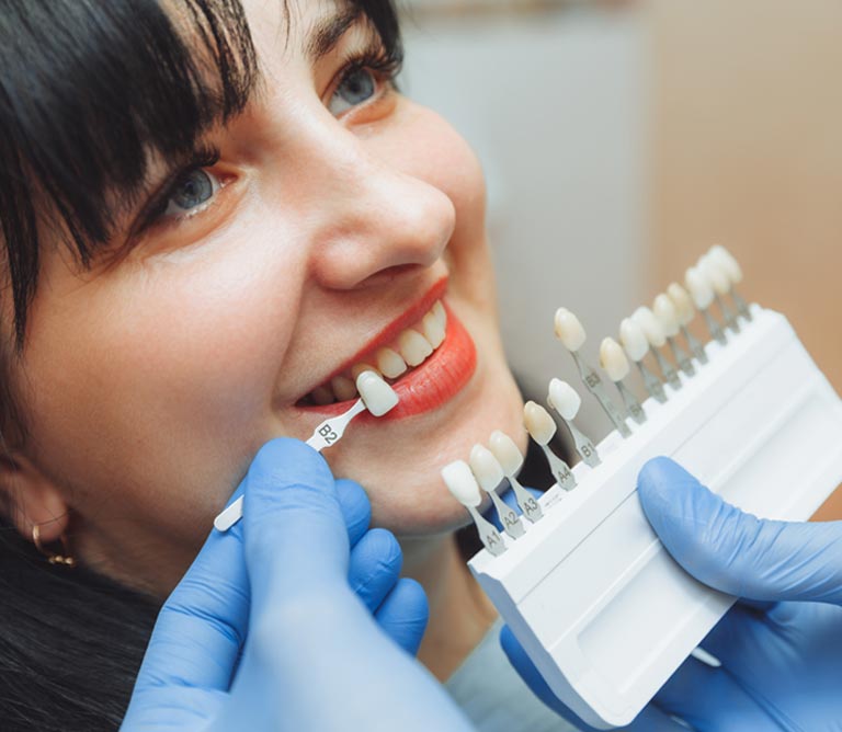 Colored Porcelain Fillings
