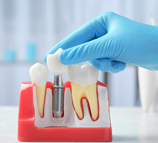 Prosthodontics
