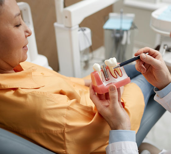 Dental Implants
