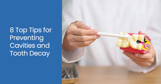 8 top tips for preventing cavities and tooth decay
