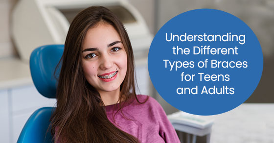 Understanding the Different Types of Braces for Teens and Adults