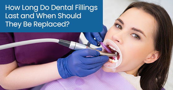 How Long Do Dental Fillings Last and When Should They Be Replaced?