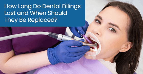 How long do dental fillings last and when should they be replaced?